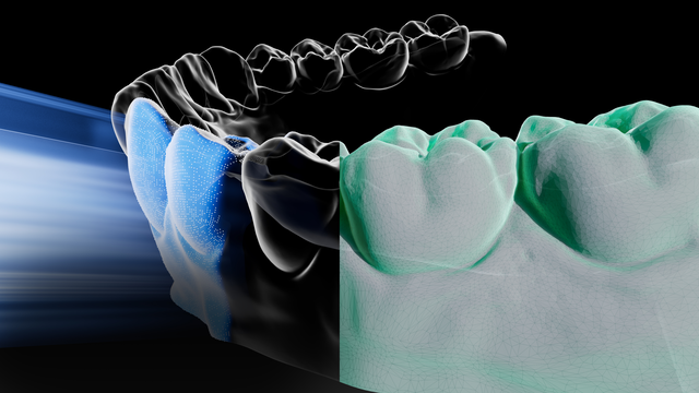 arcreal | Intraoral Scanner Arcscan
